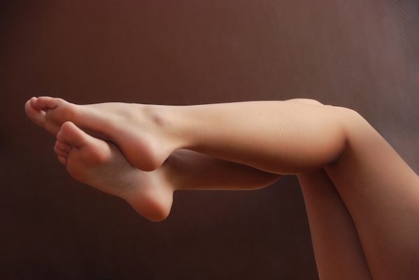 varices
